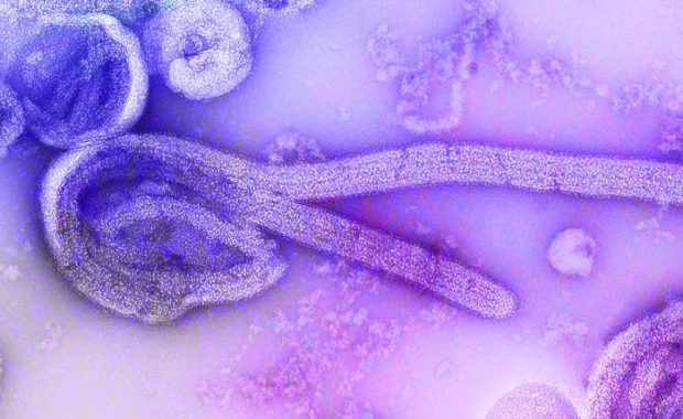 Electron microscopic image of the Ebola virus